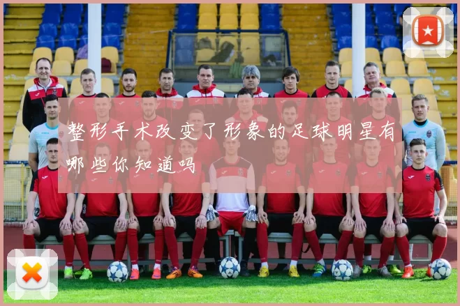 整形手术改变了形象的足球明星有哪些你知道吗